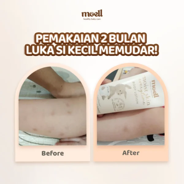 Moell Body Lotion Baby 185ml - Gambar 5